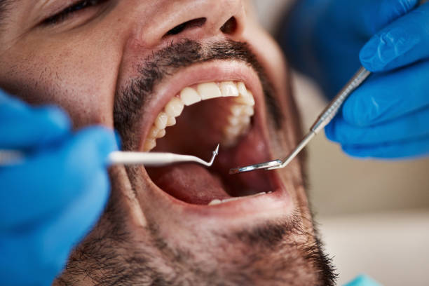 Best Pediatric Emergency Dentist in Columbus, TX