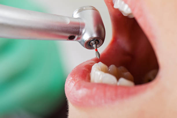 Best Cosmetic Emergency Dentistry in Columbus, TX